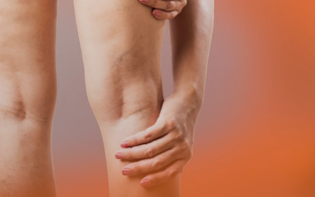 Dolor de piernas al acostarte
